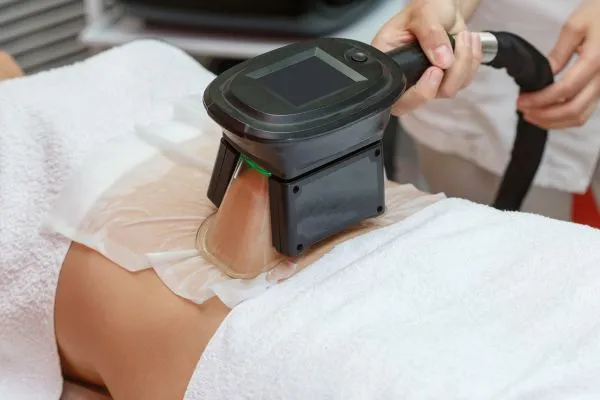 Image of person having fat freezing treatment to help weight gain Calne