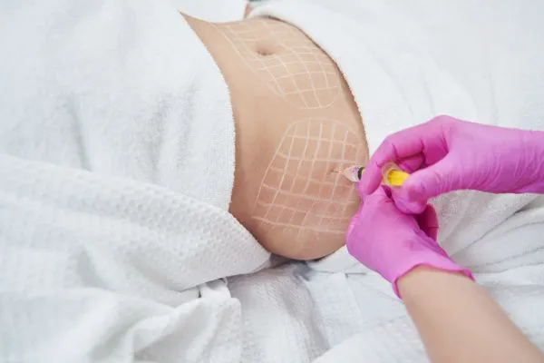 image of fat dissolving injections on love handles to help combat weight gain Calne