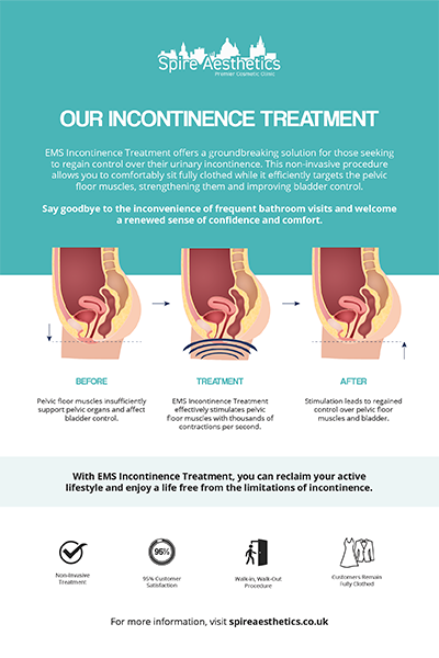 image to show how EMS treatment works for female urinary incontinence Calne
