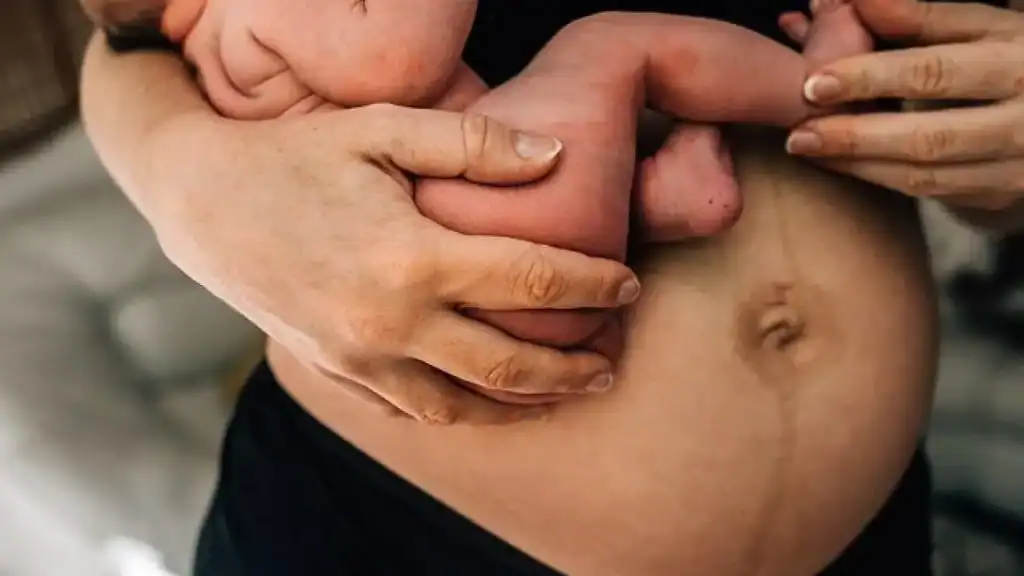 Why Is My Stomach Still Big After Pregnancy Calne?